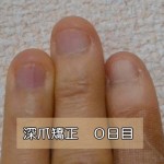 深爪やめる0日目