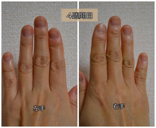 爪噛み克服４週間