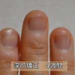 深爪・爪噛み克服４週間目
