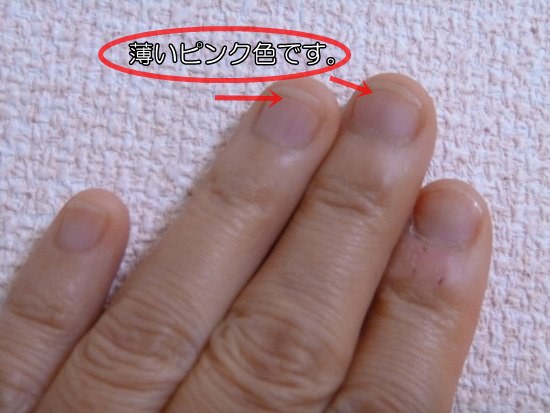 爪噛みやめて３週間