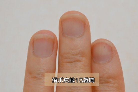 深爪克服15週間