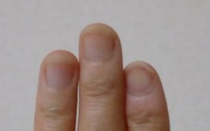 爪噛み克服９週間