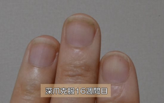 深爪克服16週間目