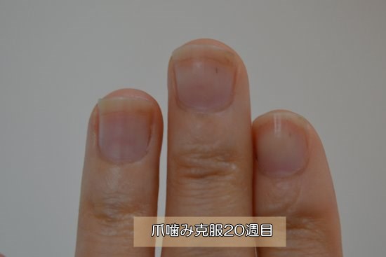 爪噛みをやめて20週目