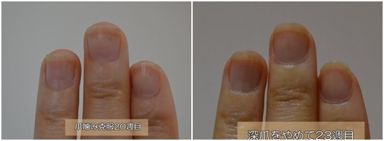 20週と23週の比較