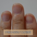 爪噛みを辞めてから26週目