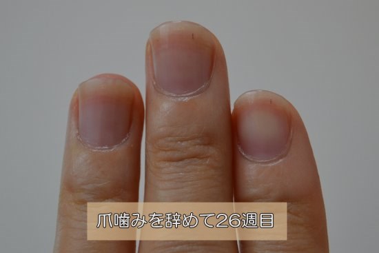 爪噛みを辞めてから26週目