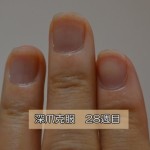 深爪を自分で治し方28weeks