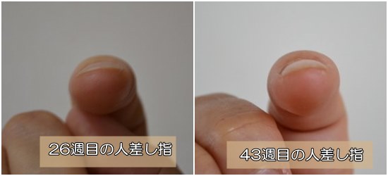 爪が扁平な悩み