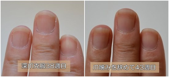 ５週間前と深爪の比較