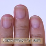 深爪を治して41週目