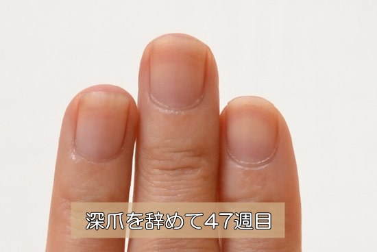 爪を噛む癖をやめて47週目