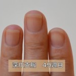 深爪克服49週目