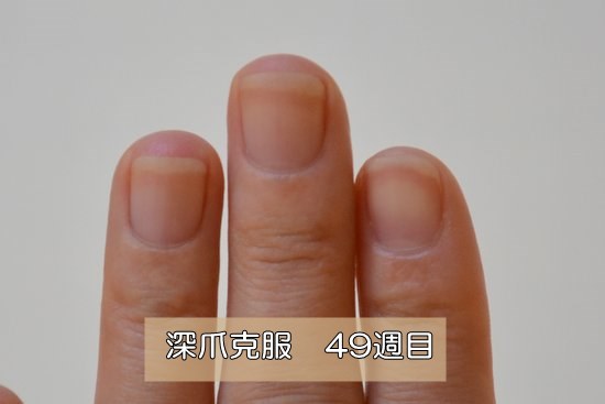 深爪克服49週目