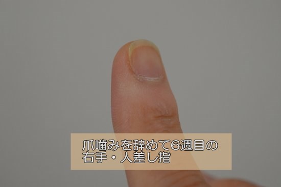深爪　女子　伸ばして1か月