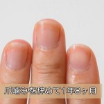深爪克服1年8ヶ月