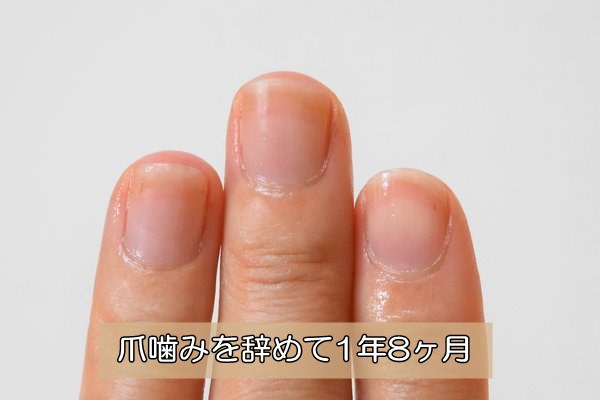 深爪克服1年8ヶ月