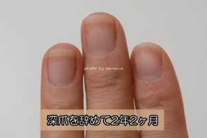 深爪を辞めて2年2か月