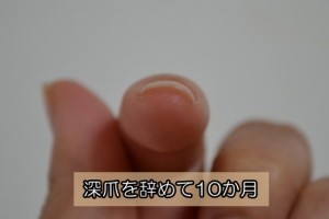 深爪を辞めて10か月