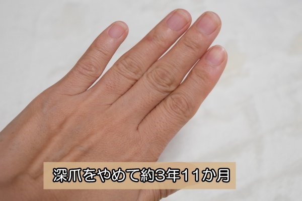 深爪を辞めて約４年　爪噛み辞める