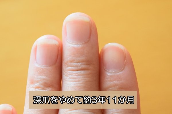 深爪をやめる　爪噛みをやめる　約４年後
