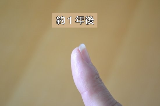 深爪　女子　伸ばして1年後